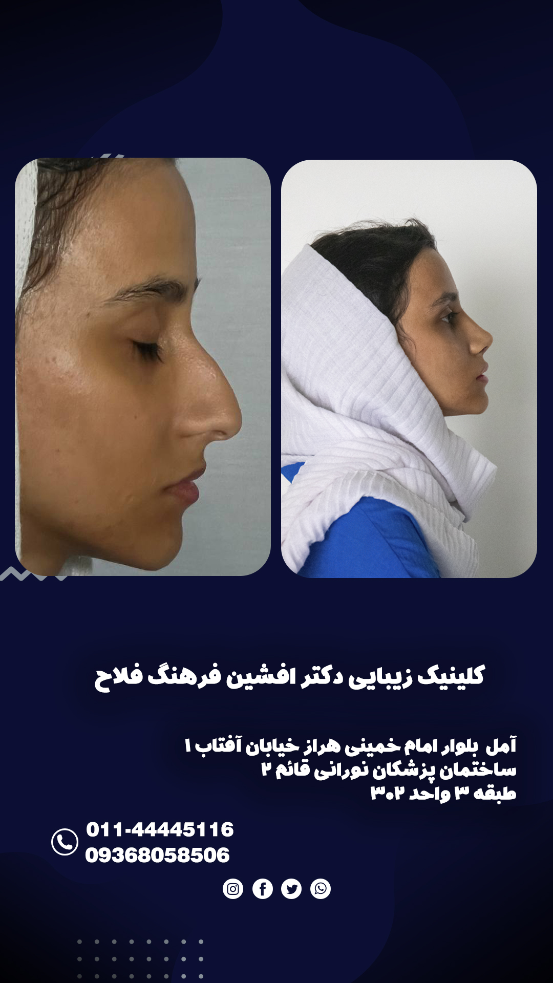 بهترین جراح زیبایی مازندران