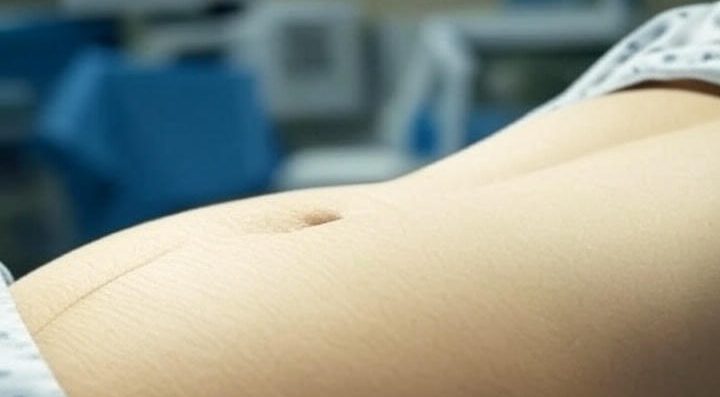 نتایج جراحی شکم (آبدومینوپلاستی) قبل و بعد از عمل توسط دکتر فرهنگ فلاح