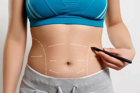 لاغری با دستگاه PAL | لیپوساکشن در آمل