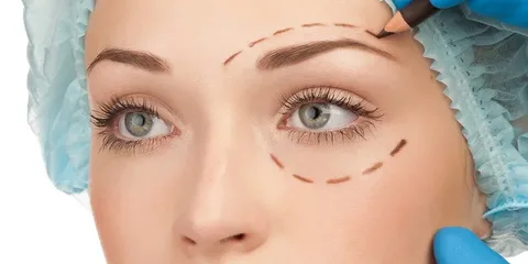 جراحی پلک در آمل