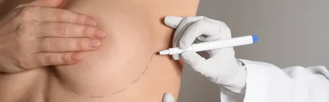 بازسازی پستان بعد از سرطان در آمل