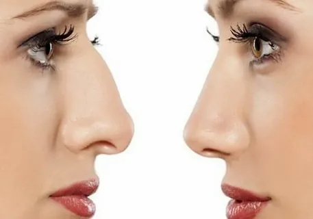 بهترین دکتر زیبایی در آمل