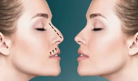 پیزوسرجری در آمل دکتر افشین فرهنگ فلاح