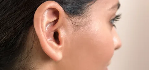جراحی زیبایی و ترمیمی گوش (اتوپلاستی) در آمل