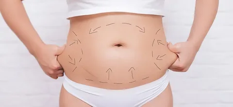 ابدومینوپلاستی زنان در آمل
