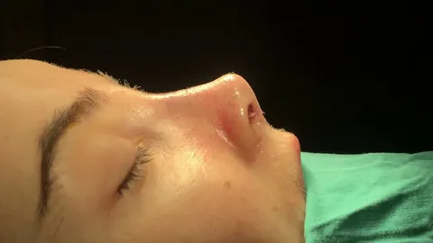 بهترین جراح بینی در آمل 8 بهترین جراح بینی در آمل