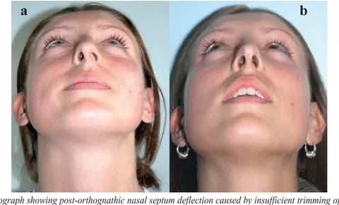 بهترین جراح بینی در آمل 2 بهترین جراح بینی در آمل