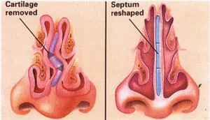 بهترین جراح بینی در آمل 4 بهترین جراح بینی در آمل