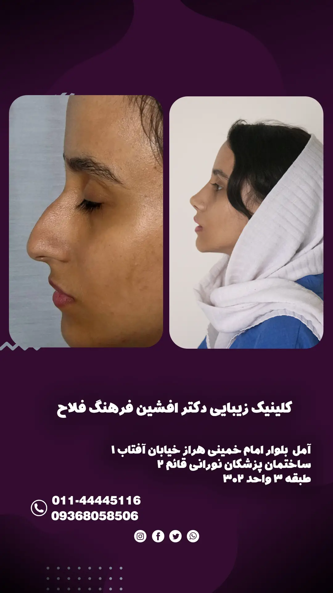 بهترین جراح زیبایی مازندران