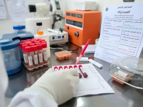  عمل بینی در آمل